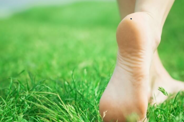 Nốt ruồi ở gót chân báo hiệu điều gì?